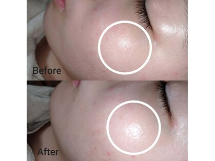 シュガーリングハウスレディ(SugaringHouse LADY)の写真