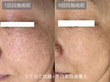 リアン/肌印象ケア