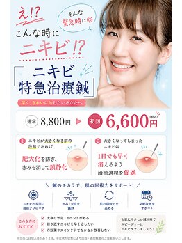 北千住整骨院の写真/えっこんな時にニキビ！？そんなピンチには北千住整骨院の特急ニキビケア鍼★がオススメです◎