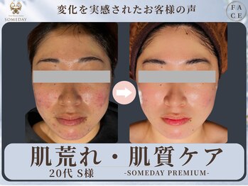 サムデイ プレミアム 新宿西口店(SOMEDAY)/FACE