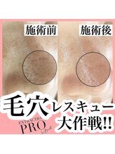 エフドット(f.)/