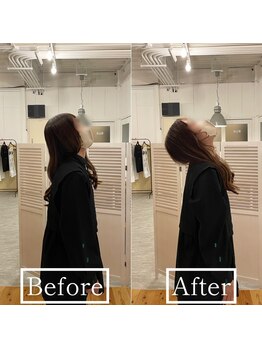 ビギニングフィットネス(Beginning fitness)/美容整体ビフォーアフター