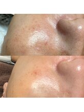 アストリア(ASTORIA)/芸能界で人気のエクソソーム