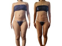 アンドゥ 津田沼(Undo)/最短.最速で痩せたい！