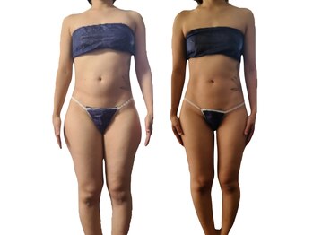 アンドゥ 津田沼(Undo)/最短.最速で痩せたい!