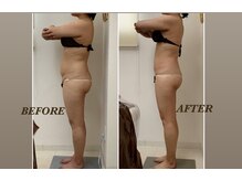 プリマ(Prima)/BEFORE&AFTER