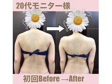 スワン 新栄店(SWAN)/【20代モニター様】初回で驚き！