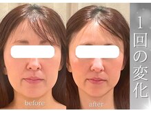 ソナ 大和西大寺院(SONA)/医療でしか叶わないと思っていた