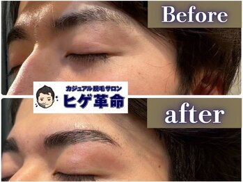 ヒゲ革命 難波日本橋/【驚きの仕上がり】HBL★