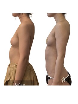 ベンザイ 梅田店(BENZAI)/筋肉質、痩せにくい体質