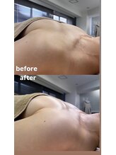 ルミエール(Lumiere)/【倉敷市】バストアップ施術事例