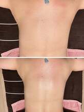 カモミール(Camomille)/背中美人ケア