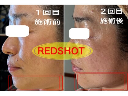 ナニ(nani)の写真