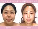 小顔フェイスラボ 神戸元町店(小顔 Face Labo.)の写真