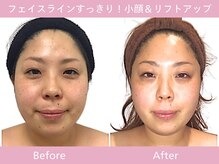 小顔フェイスラボ 神戸元町店(小顔 Face Labo.)