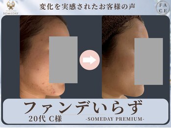 サムデイ プレミアム 新宿西口店(SOMEDAY)/FACE
