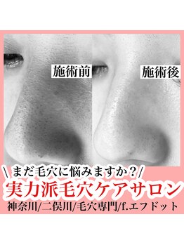 エフドット(f.)/