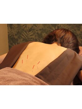 腰のつらさを改善したい