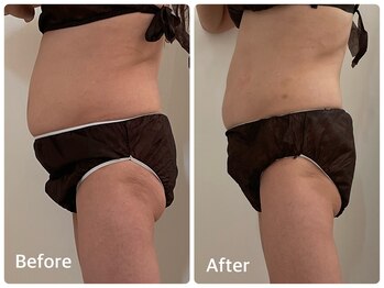 ナビ(NABI)/【人気No.1】ぽっこりお腹撃退