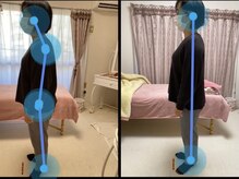 初回の施術前→施術後