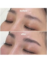 ティニー(Tiny)/HBL