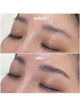 ティニー(Tiny)/HBL