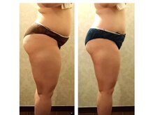 バービーホリック(barbie holic)/１６０コース　初回と７回目比較