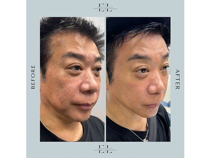 ブリーシル(Briicil)の写真