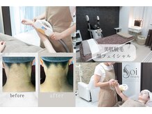 ソイビューティー(Soi beauty)の雰囲気（寝られるくらい痛みの少ない最新美肌脱毛♪美容成分でつるん肌に）