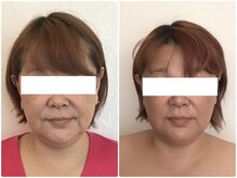 ウェリナ平和堂長久手院/小顔矯正/骨盤矯正/美脚サロン