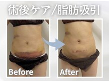 アピ(api)の雰囲気（術後ケアの得意なサロン。少ないインディバ回数でも効果を実感。）