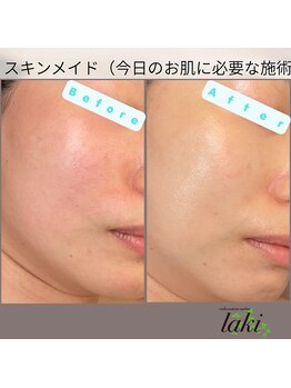 リラクゼーションサロン ラキ(laki)/スキンメイドお肌に合った施術