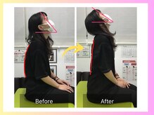 ナオル整体 川越院(NAORU整体)/首こり解消ビフォーアフター