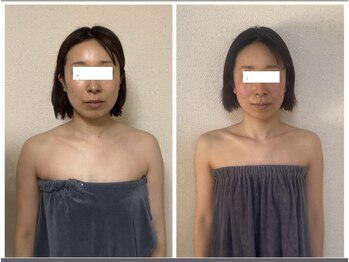 カムイ/姿勢矯正/小顔矯正