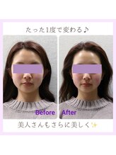 ヴィヴィ(ViVi)/水流し小顔矯正ができます★