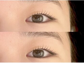 シエンテ(Ciente)/奥二重さん