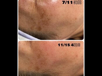 プラチナヒーリング(PLATINUM HEALING.)