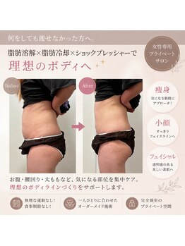 ミージュ(Miiju.)の写真/何をしても痩せなかった方へ
