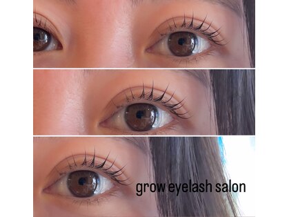 グロウ アイラッシュ(grow eyelash)の写真