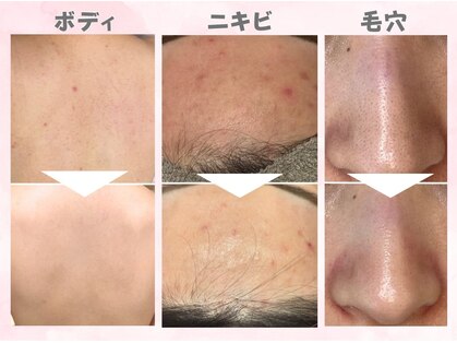 メイリリー(Meilily)の写真