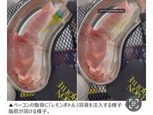 ハイフン(HIFUN)/【小顔脂ヨウ溶解レモンボトル】