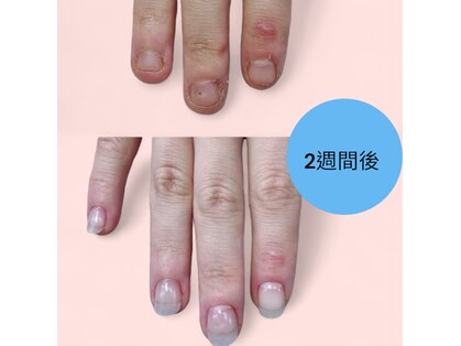 チャームドロップの写真