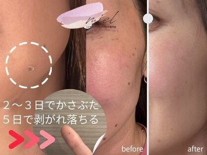 ミエル(miel)の写真