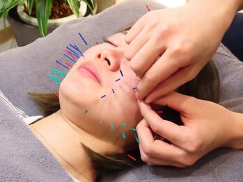 飯田橋駅前鍼灸整骨院/たるみの改善に【飯田橋/鍼灸】