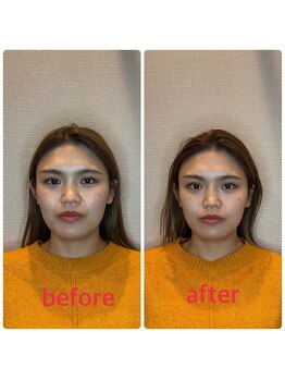 小林整骨院 本町/【左右バランスの調整】