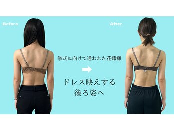 ネイト ワックス(Neit Wax)の写真/挙式に向けてドレス映えする後ろ姿へ♪背中・デコルテ・美姿勢ケア◎ バストアップ/姿勢改善/くびれ/肩甲骨