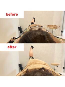 ナオル整体 福岡香椎院(NAORU整体)/50代女性施術事例【腰の痛み】