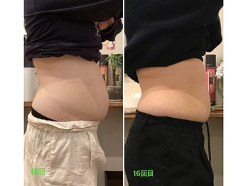 柏の葉オレンジ整体院/横から見ても変化あり◎