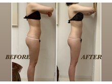 プリマ(Prima)/BEFORE&AFTER