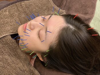 宮町鍼灸整骨院の写真/【身体もケアする美容鍼★】乾燥ダメージ、お疲れ肌のケアに◎お肌もケアしつつ身体の不調にもアプローチ♪